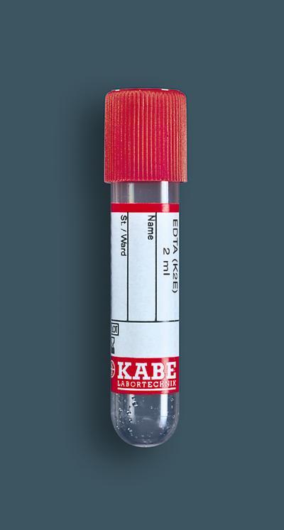 Пробірка ЕДТА 55 ППн 2 мл (12 мм x 55 мм)